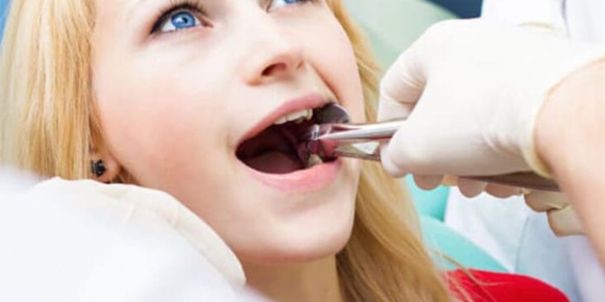 Visiting your Melbourne CBD Dentist After a Long Gap: What to Expect?